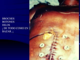 BROCHES BOTONES HILOS ¡ DE TODO COMO EN BAZAR. ¡ 