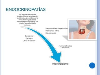 ENDOCRINOPATÍAS 