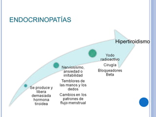 ENDOCRINOPATÍAS Hipertiroidismo 