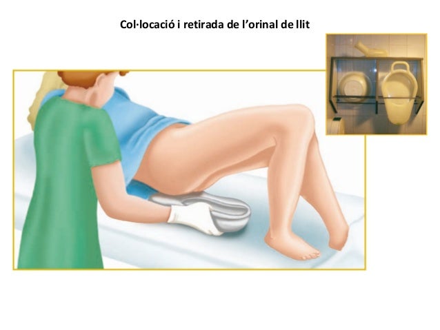 Manejo del orinal. Orinal de tipo cuña