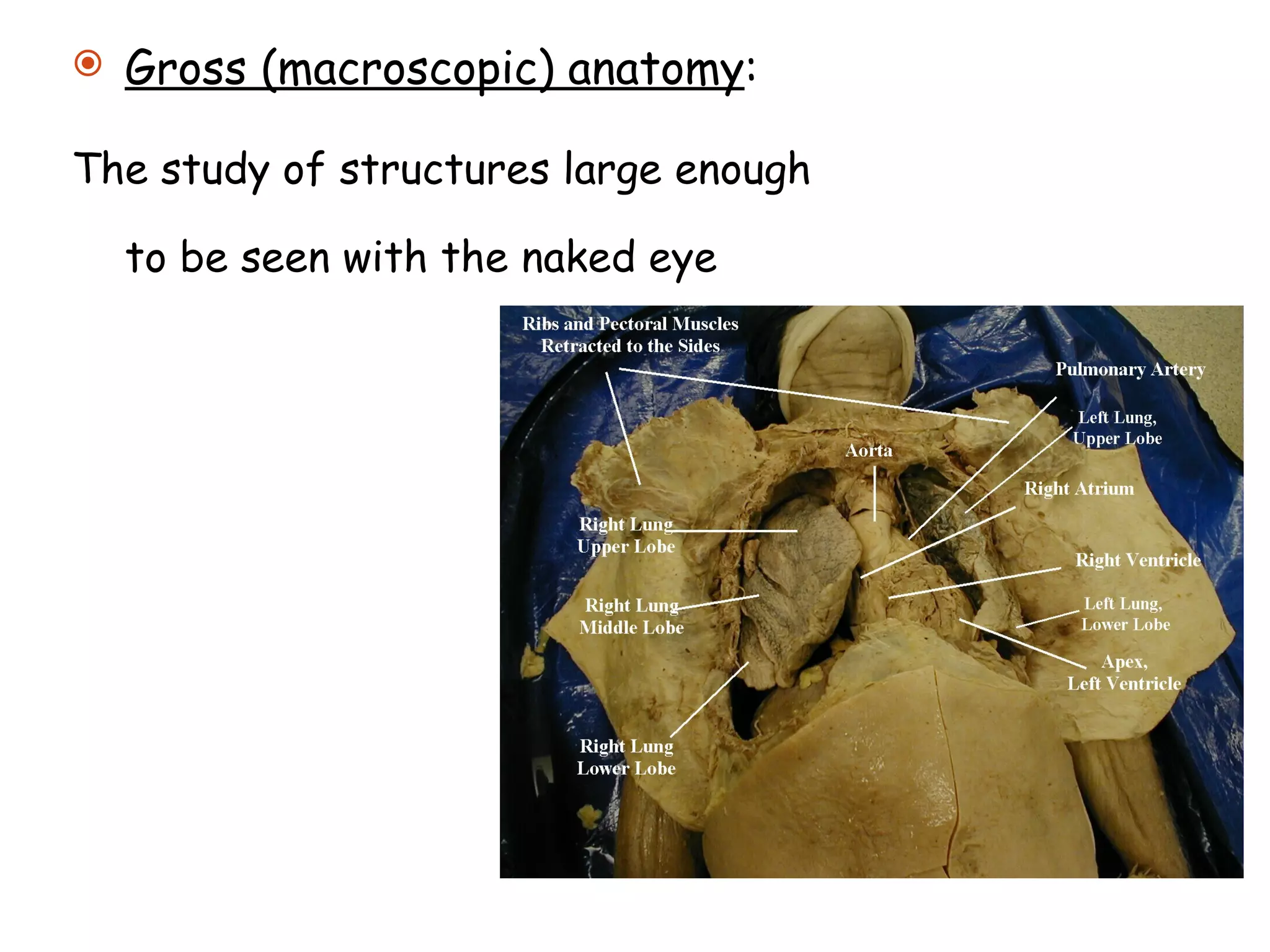 Gross (macroscopic) anatomy : The study of structures large enough to be seen with the naked eye 