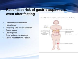 Patients at risk of gastric aspiration
even after fasting
• Gastrointestinal obstruction
• Hiatus hernia
• Pregnancy (2nd and 3rd trimester)
• Severe trauma
• Use of opioids
• Acute abdomen (any cause)
• Raised intraabdominal pressure
 