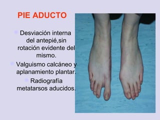 1. anomalias congénitas | PPT