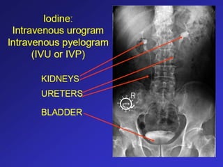 Comprehensive Radiologic Anatomy and Imaging Techniques Explained | PPT