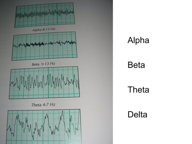 ِAssessment Instruments in Sleep ~ Prof. Dr. Tarek Asaad | PPT | Sleep ...
