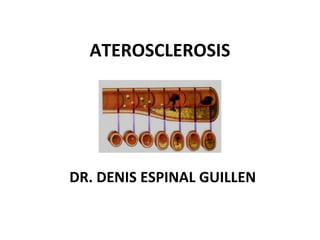 ATEROSCLEROSIS DR. DENIS ESPINAL GUILLEN 