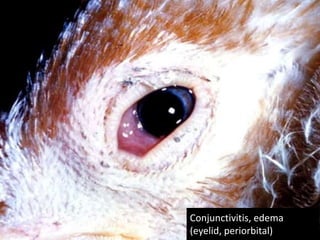 Post Mortem Lesions
In uncomplicated cases in chickens, the lesions typically
include:
1. Mild sinusitis
2. Tracheitis
3. Airsacculitis
If chicken is infected concurrently with E. coli:
1. Thickening and turbidity of the air sacs
2. Exudative accumulations
3. Fibrinopurulent pericarditis
4. Perihepatitis
 