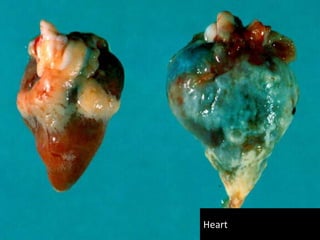 Treatment – Live Bird
 The (semi) permanent use of antibiotics (Tylan ®,
Lincospectin®, Baytril®) can reduce the damage of a M.G.
infection, but it will never really solve the problem, because
the flocks are still infected.
 In broilers, at the first 4 days of life, then at 19th day for 2
successive days.
 In breeders, following any respiratory vaccination, especially
ND for 2 successive days.
 As soon as one stops the medication the disease increases
again
 