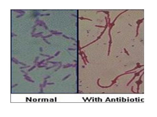1 basic characters of bacteria