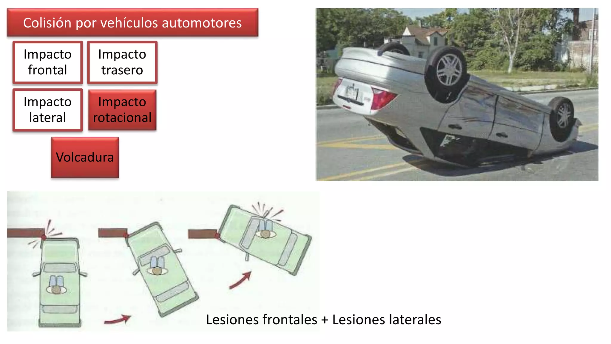 Biomecánica del trauma | PPTX | Death, Injury, or Military Conflict ...