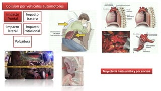 Biomecánica del trauma | PPTX