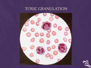 TOXIC GRANULATION
 