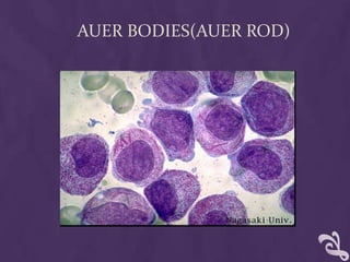 AUER BODIES(AUER ROD)
 
