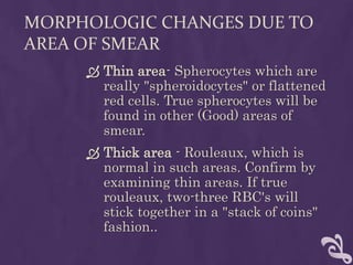 MORPHOLOGIC CHANGES DUE TO
AREA OF SMEAR
 Thin area- Spherocytes which are
really "spheroidocytes" or flattened
red cells. True spherocytes will be
found in other (Good) areas of
smear.
 Thick area - Rouleaux, which is
normal in such areas. Confirm by
examining thin areas. If true
rouleaux, two-three RBC's will
stick together in a "stack of coins"
fashion..
 