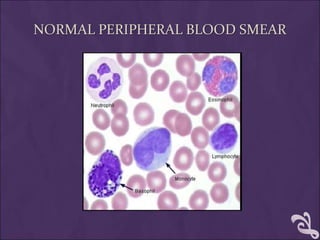 NORMAL PERIPHERAL BLOOD SMEAR
 
