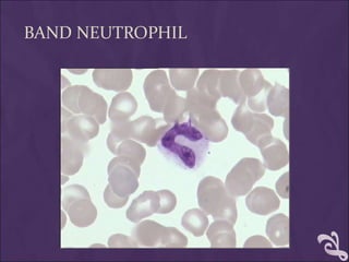 BAND NEUTROPHIL
 