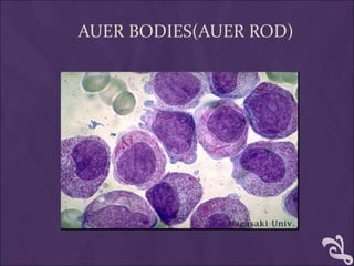 AUER BODIES(AUER ROD)
 