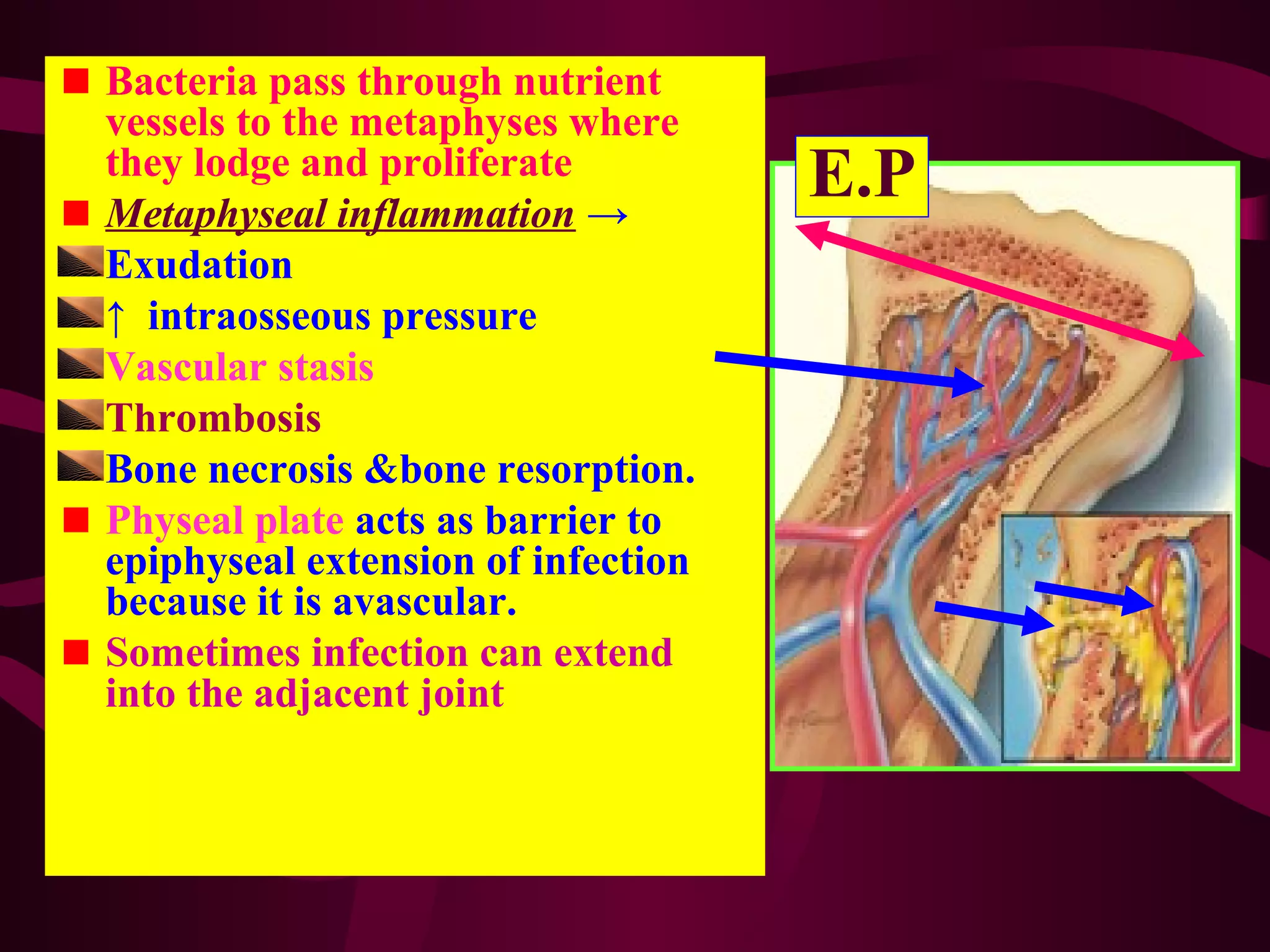 Bone and Joint Infection | PPT