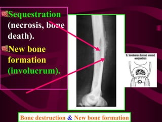 Bone destruction & New bone formation
Sequestration
(necrosis, bone
death).
New bone
formation
(involucrum).
 