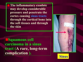 The inflammatory exudate
may develop considerable
pressure and penetrate the
cortex causing sinus tracts
through the cortical bone into
the soft tissues and through
the skin
Sinus
Squamous cell
carcinoma in a sinus
tract (A rare, long-term
complication ).
 