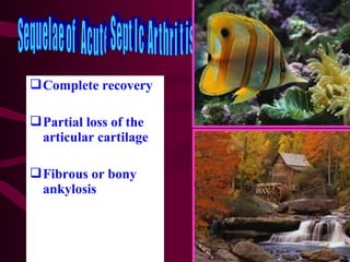 Complete recovery
Partial loss of the
articular cartilage
Fibrous or bony
ankylosis
 