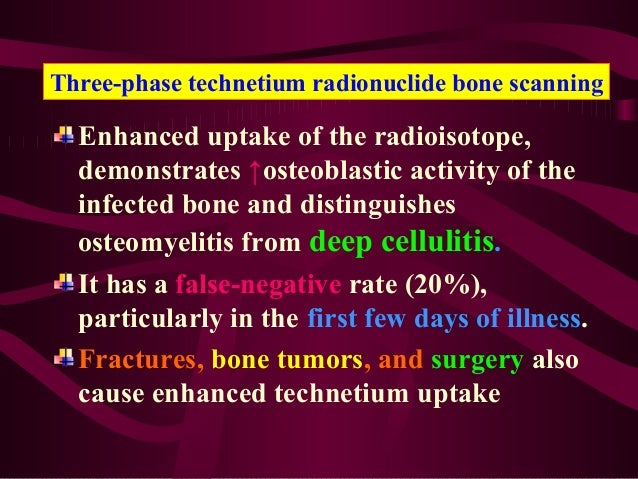 Strep infection in bone