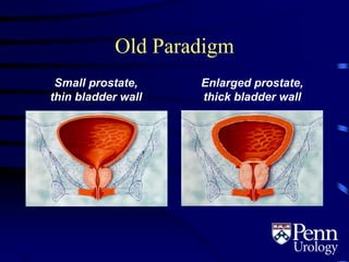 Old Paradigm
Small prostate,
thin bladder wall
Enlarged prostate,
thick bladder wall
2.2
 