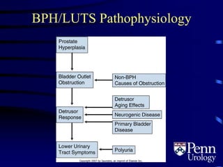 BPH/LUTS Pathophysiology
 