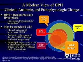 A Modern View of BPH
Clinical, Anatomic, and Pathophysiologic Changes
• BPH = Benign Prostatic
Hyperplasia
– Histologic: stromoglandular
hyperplasia1
• May be associated with
– Clinical: presence of
bothersome LUTS2
– Anatomic: enlargement of
the gland (BPE = Benign
Prostatic Enlargement)2
– Pathophysiologic: compression
of urethra and compromise of
urinary flow (BOO = Bladder
Outlet Obstruction)2
1. American Urological Association Research and Education Inc. BPH Guidelines 2003.
2. Nordling J et al. In: Chatelain C et al, eds. Benign Prostatic Hyperplasia. Plymouth, UK: Health Publication Ltd;
2001:107166.
All Men
>50 y
Histologic
BPH
BPE
Enlargement
`BOO
Obstruction
LUTS/
Bother
 
