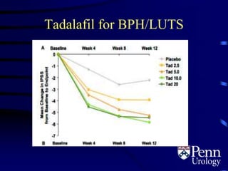 Tadalafil for BPH/LUTS
 