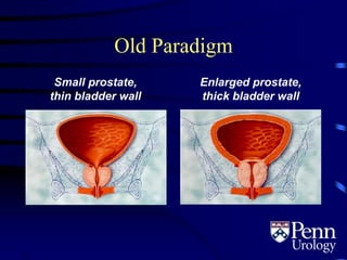 Subsequent Paradigm
Normal prostate
Enlarged prostate
Small prostate with -receptors
2.3
 
