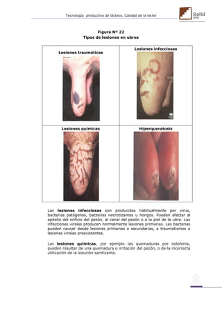 Tecnología productiva de lácteos. Calidad de la leche 
Figura Nº 22 
Tipos de lesiones en ubres 
Lesiones traumáticas 
Lesiones infecciosas 
Lesiones químicas 
Hiperqueratosis 
Las lesiones infecciosas son producidas habitualmente por virus, bacterias patógenas, bacterias necrotizantes u hongos. Pueden afectar al epitelio del orificio del pezón, al canal del pezón o a la piel de la ubre. Las infecciones virales producen normalmente lesiones primarias. Las bacterias pueden causar desde lesiones primarias o secundarias, a traumatismos o lesiones virales preexistentes. 
Las lesiones químicas, por ejemplo las quemaduras por iodoforos, pueden resultar de una quemadura o irritación del pezón, o de la incorrecta utilización de la solución sanitizante. 
 
