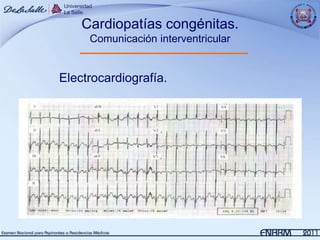Cardiopatías congénitas.
     Comunicación interventricular


Electrocardiografía.
 