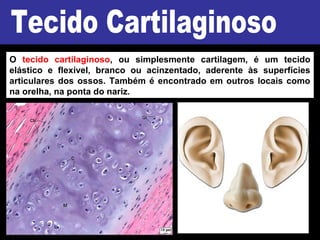O tecido cartilaginoso, ou simplesmente cartilagem, é um tecido
elástico e flexível, branco ou acinzentado, aderente às superfícies
articulares dos ossos. Também é encontrado em outros locais como
na orelha, na ponta do nariz.
 