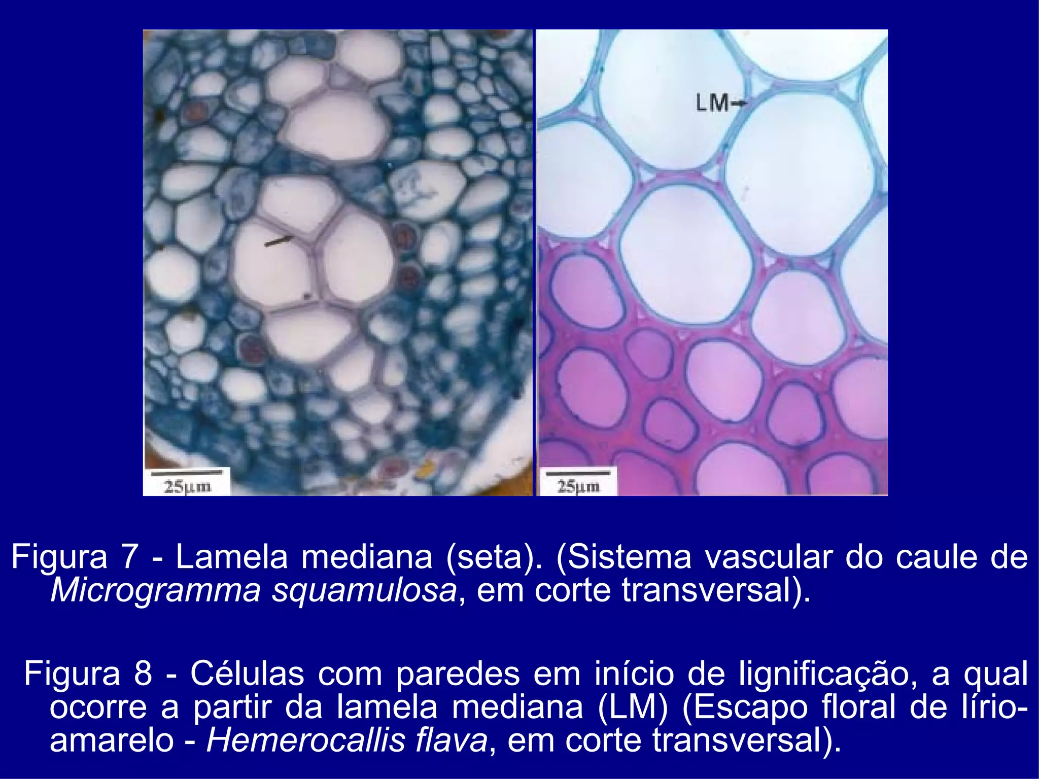 Figura 7 - Lamela mediana (seta). (Sistema vascular do caule de  Microgramma squamulosa , em corte transversal). Figura 8 - Células com paredes em início de lignificação, a qual ocorre a partir da lamela mediana (LM) (Escapo floral de lírio-amarelo -  Hemerocallis   flava , em corte transversal). 