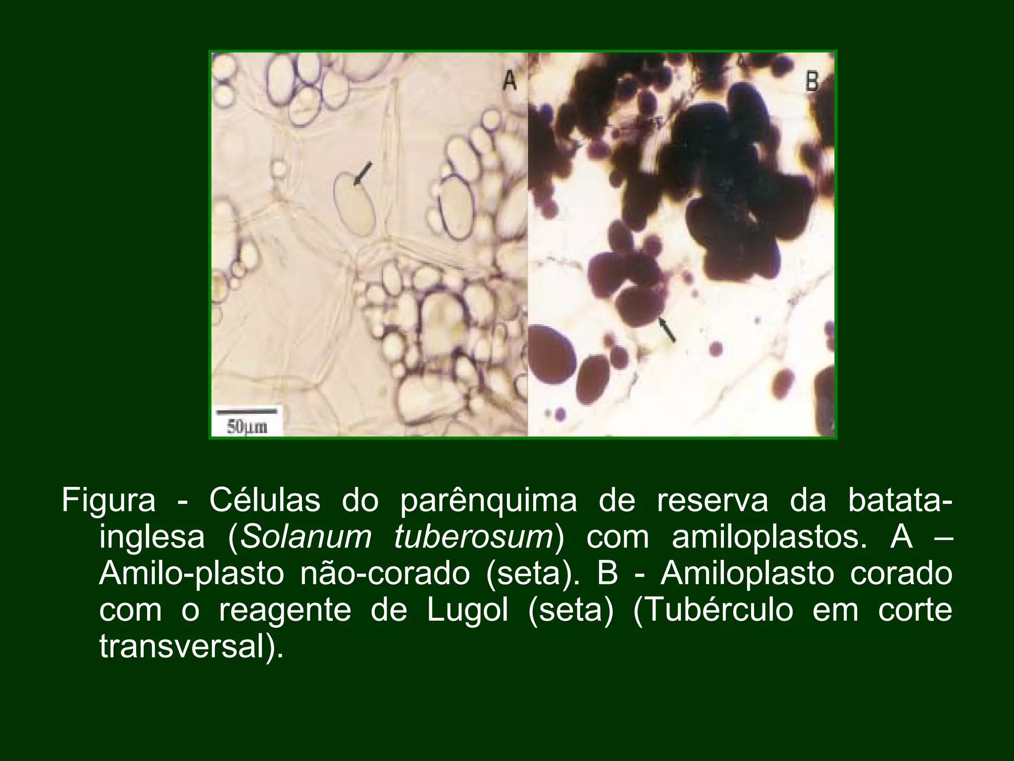 Figura - Células do parênquima de reserva da batata- inglesa ( Solanum tuberosum ) com amiloplastos. A – Amilo-plasto não-corado (seta). B - Amiloplasto corado com o reagente de Lugol (seta) (Tubérculo em corte transversal). 
