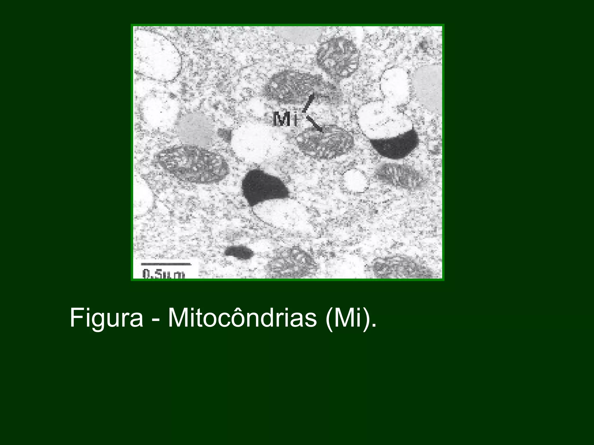 Figura - Mitocôndrias (Mi). 