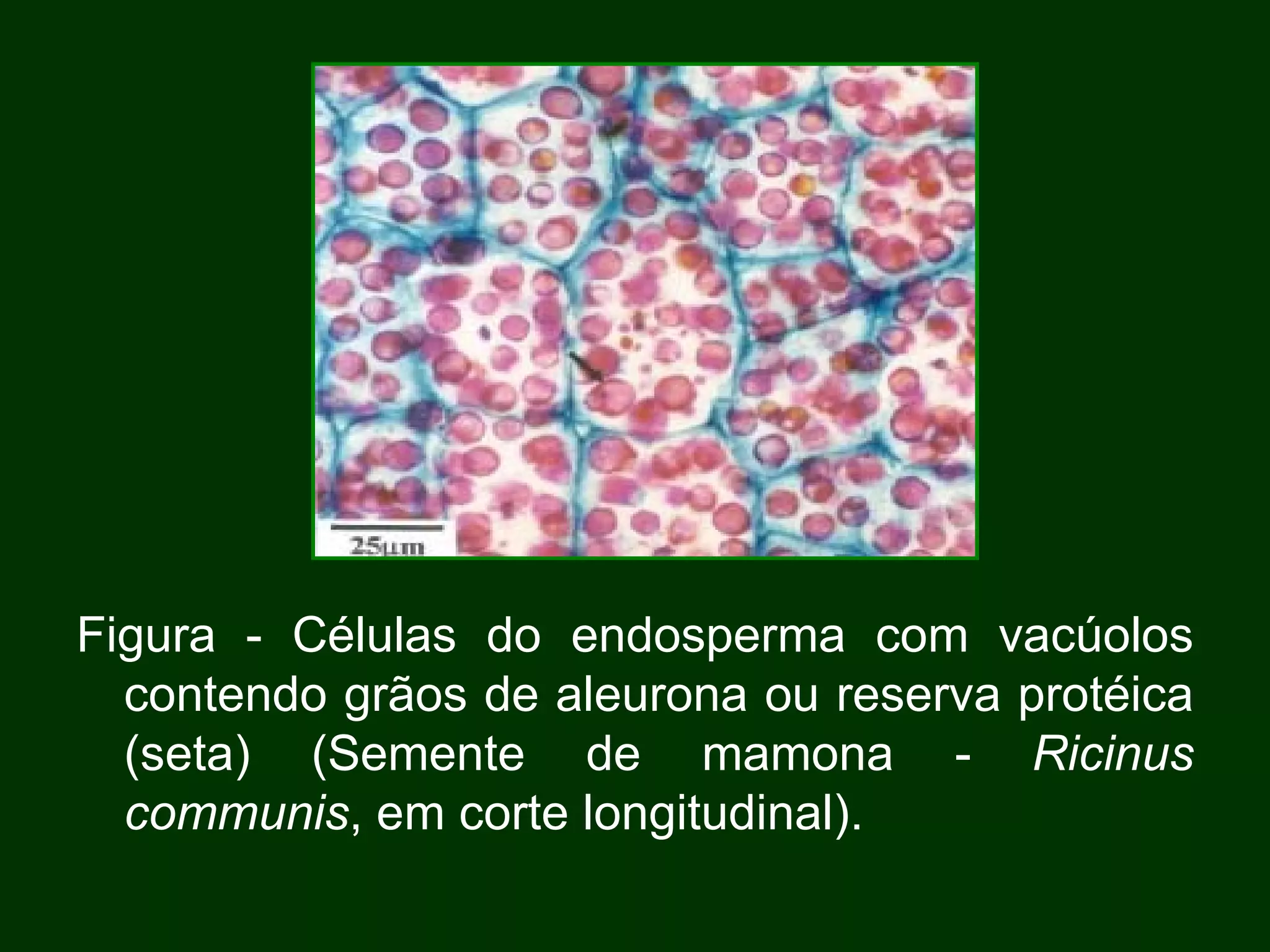 Figura - Células do endosperma com vacúolos contendo grãos de aleurona ou reserva protéica (seta) (Semente de mamona -  Ricinus communis , em corte longitudinal). 