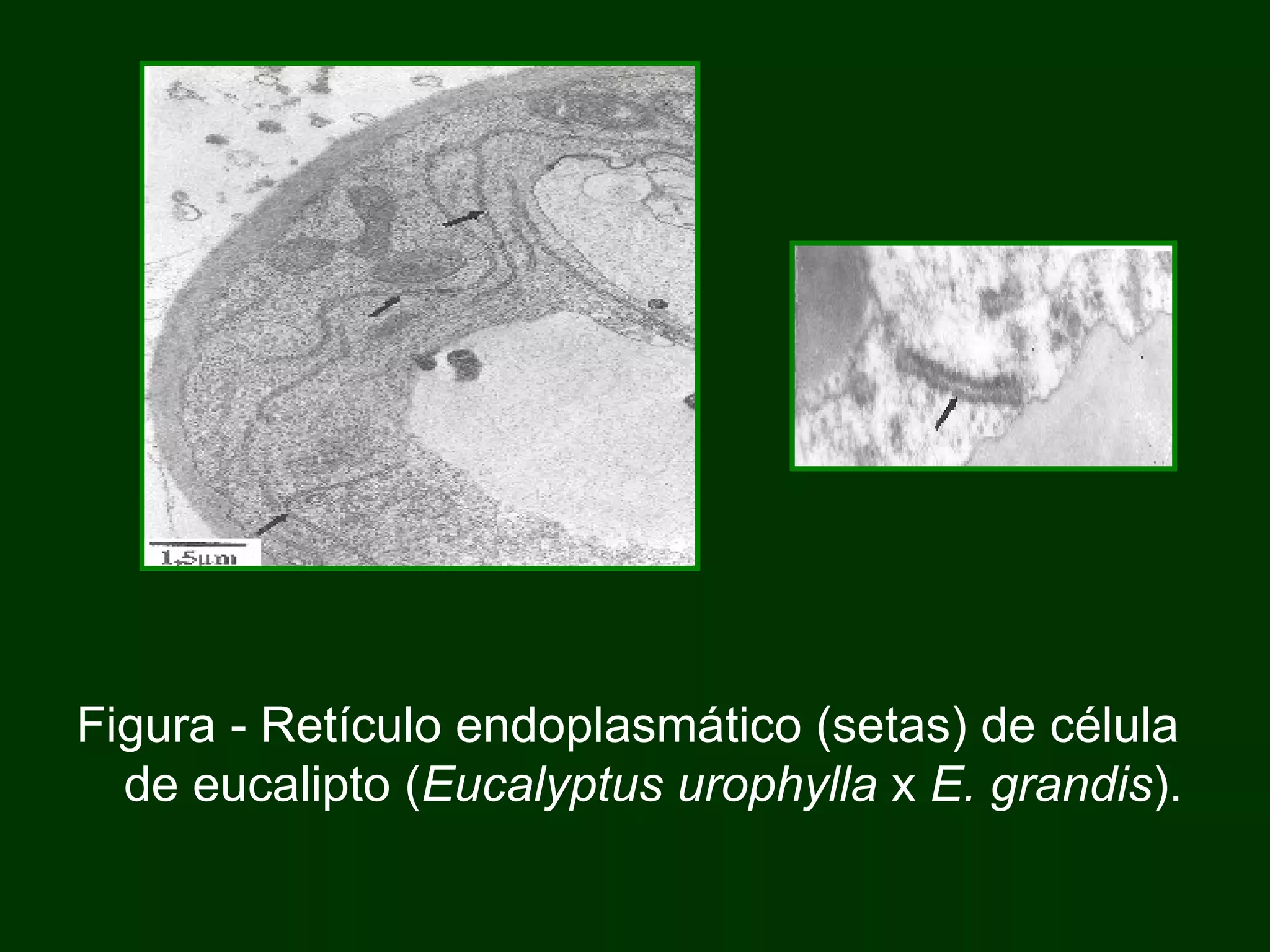 Figura - Retículo endoplasmático (setas) de célula de eucalipto ( Eucalyptus urophylla  x  E. grandis ). 