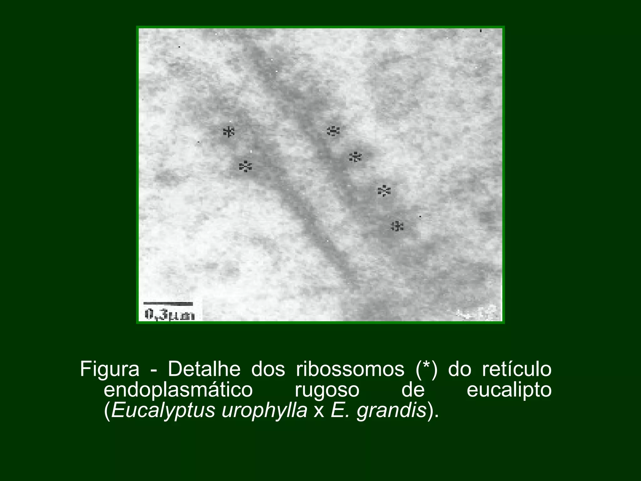 Figura - Detalhe dos ribossomos (*) do retículo endoplasmático rugoso de eucalipto ( Eucalyptus urophylla  x  E. grandis ). 