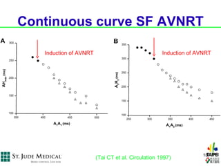 Continuous curve SF AVNRT

   Induction of AVNRT                               Induction of AVNRT




                                                                   18
                        (Tai CT et al. Circulation 1997)
 