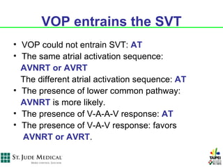 VOP entrains the SVT
• VOP could not entrain SVT: AT
• The same atrial activation sequence:
  AVNRT or AVRT
  The different atrial activation sequence: AT
• The presence of lower common pathway:
  AVNRT is more likely.
• The presence of V-A-A-V response: AT
• The presence of V-A-V response: favors
  AVNRT or AVRT.
 
