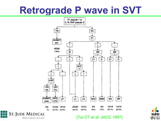 Retrograde P wave in SVT




           (Tai CT et al. JACC 1997)
 