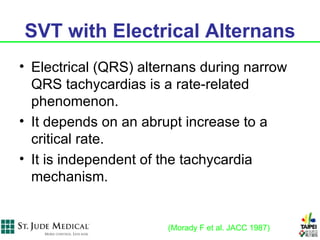 SVT with Electrical Alternans
• Electrical (QRS) alternans during narrow
  QRS tachycardias is a rate-related
  phenomenon.
• It depends on an abrupt increase to a
  critical rate.
• It is independent of the tachycardia
  mechanism.


                       (Morady F et al. JACC 1987)
 