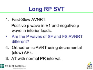 Long RP SVT
1. Fast-Slow AVNRT:
   Positive p wave in V1 and negative p
   wave in inferior leads.
• Are the P waves of SF and FS AVNRT
   different?
4. Orthodromic AVRT using decremental
   (slow) APs.
3. AT with normal PR interval.
 