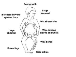 1- Congenital and aquired bone disease.pptx
