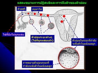 ภาพขยายตัวอ่อนระยะที่ กำลังจะผังตัวในผนังมดลูก ตัวอ่อนในระยะที่กำลัง จะฝังตัวในผนังมดลูก ตัวอ่อนระยะต่างๆ ( ไข่ที่ถูกผสมแล้ว ) ท่อนำไข่ เชื้ออสุจิ เชื้ออสุจิ ตัวอสุจิ ไข่ที่ยังไม่ถูกผสม แสดงขบวนการปฏิสนธิและการฝังตัวของตัวอ่อน เชื้ออสุจิ ท่อนำไข่ 
