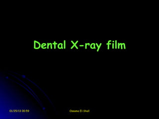 Dental X-ray film




01/25/13 00:59         Ossama El-Shall
 