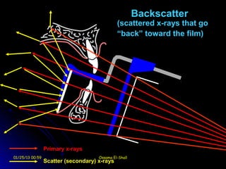 Backscatter
                                              (scattered x-rays that go
                                              “back” toward the film)




                 Primary x-rays
01/25/13 00:59                       Ossama El-Shall
                 Scatter (secondary) x-rays
 