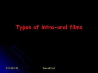 Types of intra-oral films




01/25/13 00:59       Ossama El-Shall
 